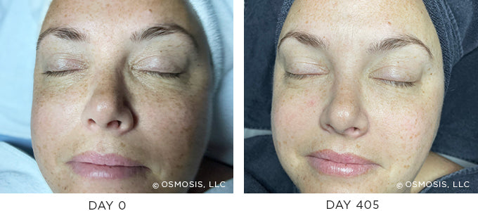 Before and After Aging Results