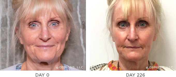 other ba kb front recovery update